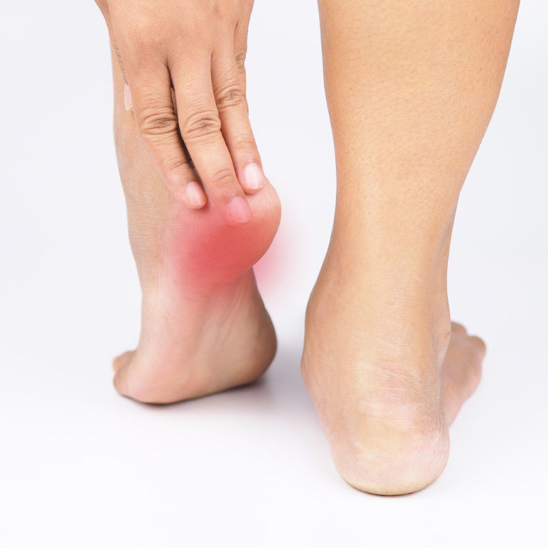 Read more about the article Three exercises to help fix Heel Pain